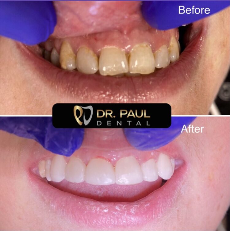 Dentistry Explained! – Dr. Paul Dental – Cornwall