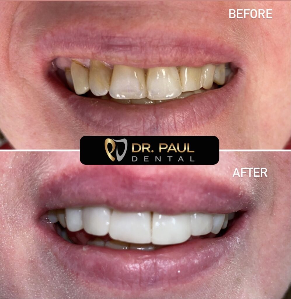 Dentistry Explained! – Dr. Paul Dental – Cornwall